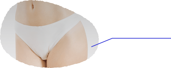 VIOの乾燥によるくすみが気になる…