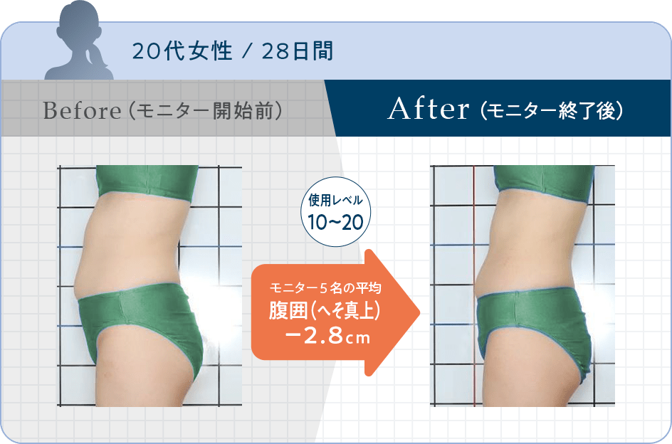 スレンダーパッド 3 PRO（Sサイズ）(S): 美容機器｜TBCオンラインショップ